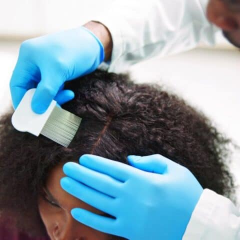 Woman on treatment from dandruff