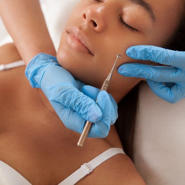Black female getting treated in face by a dermatologist