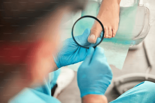 Gloved hands examining toenail with magnifying glass